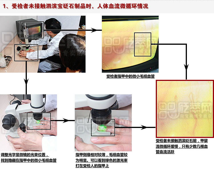 甲襞流微循環(huán)測試